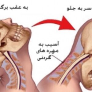 پاورپوینت آسیب های ناحیه گردن