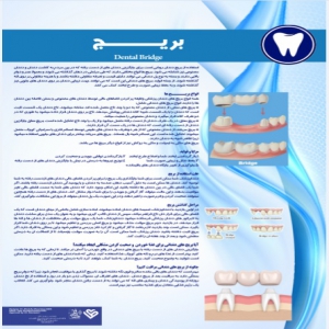 پوستر بریچ دندانی - مجموعه پوسترهای دندانپزشکی