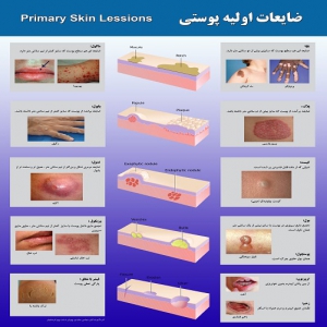 پوستر ضایعات اولیه پوستی