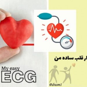 نوار قلب ساده من : خواندن نوار قلب بیمار به روشی نوین