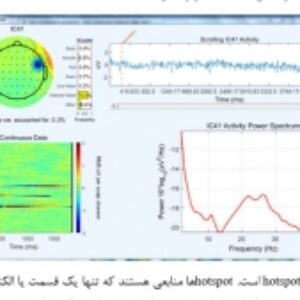 گزارش کارآموزی (0 تا 100) ثبت و پیش پردازش سیگنال الکتروانسفالوگرام EEG
