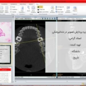پاورپوینت کاربرد پردازش تصویر در دندانپزشکی (انواع تصویربرداری دندانپزشکی)