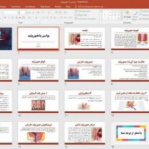 پاورپوینت بواسیر یا هموروئید