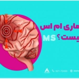 مقاله جامع و کامل بیماری ام اس MS در 44 صفحه ورد