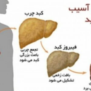 hepatitis - Cirrhosis of the liver(سیروز کبدی - هپاتیت)
