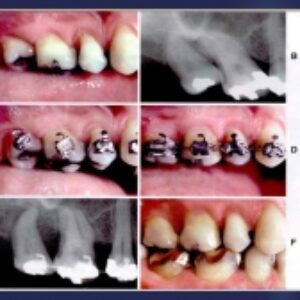 پاورپوینت آماده نقش کمکی درمان ارتودنسی(Adjunctive Role of Orthodontic Therapy)