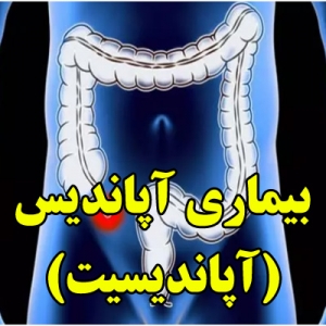 بیماری آپاندیس یا آپاندیسیت