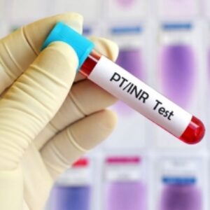 ویدیوی نحوه انجام آزمایش PT و PTT