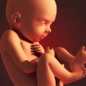 دانلود پاورپوینت اختلالات مایع آمنیوتیک Disorders of amniotic fluid در 24 اسلاید