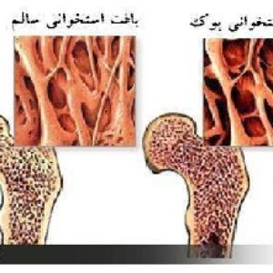 نقش ورزش در سلامت استخوان و کاهش پوکی استخوان