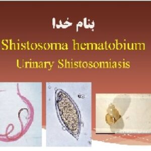 شیستوزوما هماتوبیوم    Shistosoma hematobium