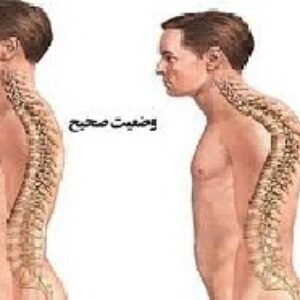 دانلود تحقيق در مورد قوس ناحيه پشتي يا گرد پشتي