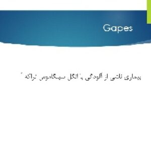 پاورپوینت Gapes (سینگاموس تراکه آ)