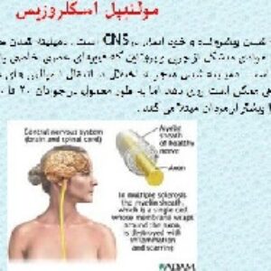 باوربوینت درمورد بیماریهای خودایمنی دستگاه عصبی