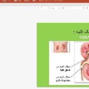 پاورپوینت بیماری سنگ کلیه