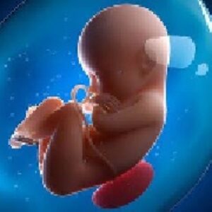 پاورپوینت درباره پاره شدن زودرس غشاهاي جنيني PROM