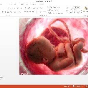 پاورپوینت سقط جنین (پزشکی قانونی )