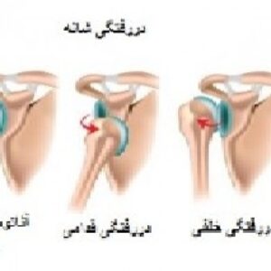 پاورپوینت کامل و جامع با عنوان آشنایی با دررفتگی و انواع آن در تربیت بدنی در 42 اسلاید