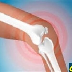 تحقیق پوكي استخوان یا استئوپروز