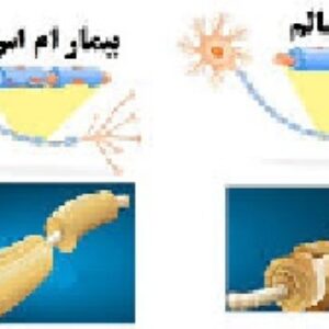 تحقیق بیماری ام اس و علائم آن