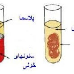 پلاسما