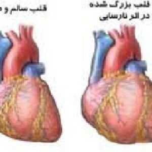 پاورپوینت نارسایی احتقانی قلب (CHF)