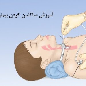 پاورپوینت آموزش ساکشن کردن راه هوایی به خانواده بیمار