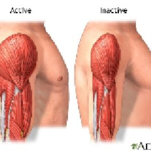 دیستروفی ما هیچه ای روشن