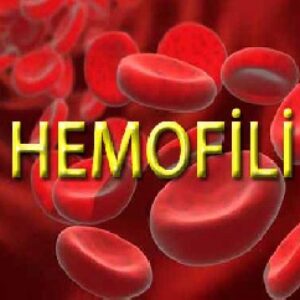 هموفیلی - Hemophilia