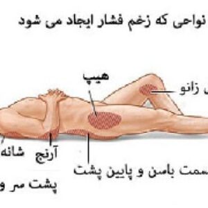 جزوه آموزشی زخم بستر؛ شناخت،پیشگیری و درمان (جزوه بدسور)