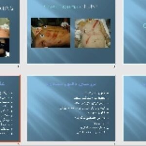 پاورپوينت با عنوان تروما قفسه سینه Chest Trauma