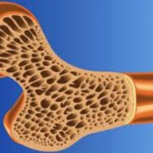 پاور پوینت, پیشگیری از پوکی استخوان با ورزش,36اسلاید,pptx