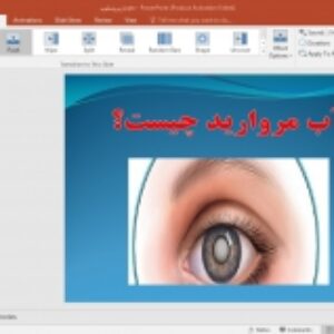 پاورپوینت آب مروارید
