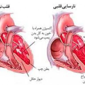 پاورپوینت نارسایی قلبی