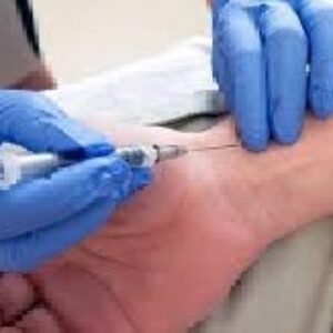 آزمایش گازهای خون شریانی ( ABG )